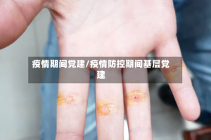 疫情期间党建/疫情防控期间基层党建